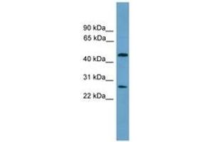 Image no. 1 for anti-Elongator Acetyltransferase Complex Subunit 4 (ELP4) (AA 101-150) antibody (ABIN6744601) (ELP4 抗体  (AA 101-150))