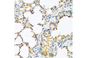 Immunohistochemistry of paraffin-embedded mouse lung using TSHB antibody (ABIN6132751, ABIN6149620, ABIN6149621 and ABIN6222522) at dilution of 1:100 (40x lens). (TSHB 抗体  (AA 21-138))