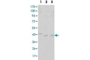 Western blot analysis of CDK9 monoclonal antibody, clone 1B5D10  against Jurkat (1), A-431 (2) and HEK293 (3) cell lysate. (CDK9 抗体)