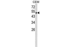 Western blot analysis of PTGIS Antibody (C-term) Cat. (PTGIS 抗体  (C-Term))