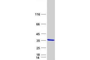 Western Blotting (WB) image for Kv Channel Interacting Protein 3, Calsenilin (KCNIP3) (Transcript Variant 1) protein (Myc-DYKDDDDK Tag) (ABIN2713075)