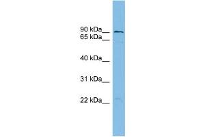 WB Suggested Anti-TBC1D16 Antibody Titration: 0. (TBC1D16 抗体  (N-Term))