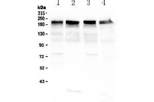 Western blot analysis of Laminin using anti-Laminin antibody .
