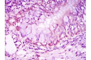 Immunohistochemistry (IHC) image for anti-Nuclear Receptor Subfamily 3, Group C, Member 1 (Glucocorticoid Receptor) (NR3C1) antibody (ABIN969321)