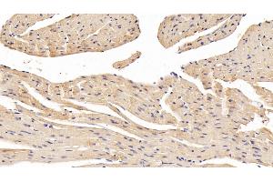 Immunohistochemistry (IHC) image for anti-Fatty Acid Desaturase 2 (FADS2) (AA 1-130) antibody (ABIN7436027)