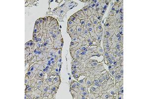 Immunohistochemistry of paraffin-embedded human stomach using Carbonic Anhydrase 9 (C/G250) antibody (ABIN6131266, ABIN6137798, ABIN6137800 and ABIN6217767) at dilution of 1:100 (40x lens). (CA9 抗体  (AA 52-151))