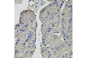 Immunohistochemistry of paraffin-embedded human stomach using Carbonic Anhydrase 9 (C/G250) antibody (ABIN6131266, ABIN6137798, ABIN6137800 and ABIN6217767) at dilution of 1:100 (40x lens). (CA9 抗体  (AA 52-151))