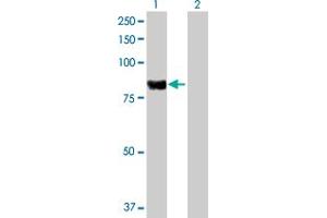 Western Blot analysis of PLA2G6 expression in transfected 293T cell line by PLA2G6 MaxPab polyclonal antibody. (PLA2G6 抗体  (AA 1-752))