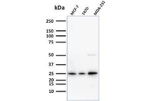 Western Blot Analysis of Human MCF-7,T47D and MDA-231 cell lysate using Monospecific Mouse Monoclonal Antibody (SPM518) to Mammaglobin. (Mammaglobin A 抗体)