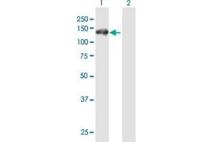 Western Blot analysis of RNF20 expression in transfected 293T cell line by RNF20 MaxPab polyclonal antibody. (RNF20 抗体  (AA 1-975))