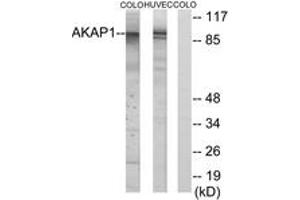 Western Blotting (WB) image for anti-A Kinase (PRKA) Anchor Protein 1 (AKAP1) (AA 281-330) antibody (ABIN2889701) (AKAP1 抗体  (AA 281-330))