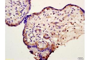 Formalin-fixed and paraffin embedded human placenta labeled with Anti-HSD11B2 Polyclonal Antibody, Unconjugated (ABIN701680) at 1:200 followed by conjugation to the secondary antibody and DAB staining (HSD11B2 抗体  (AA 151-250))