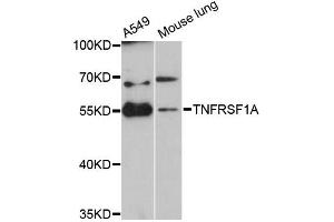 Western blot analysis of extracts of various cell lines, using TNFRSF1A antibody (ABIN5970729) at 1:3000 dilution. (TNFRSF1A 抗体)