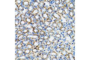 Immunohistochemistry (Paraffin-embedded Sections) (IHC (p)) image for anti-Catenin (Cadherin-Associated Protein), alpha 1, 102kDa (CTNNA1) (AA 637-906) antibody (ABIN6139202)