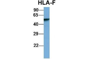 Host:  Rabbit  Target Name:  HLA-F  Sample Type:  Human Fetal Lung  Antibody Dilution:  1. (HLA-F 抗体  (N-Term))