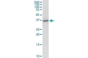 Western Blotting (WB) image for anti-Ventral Anterior Homeobox 1 (VAX1) (AA 1-100) antibody (ABIN524408)