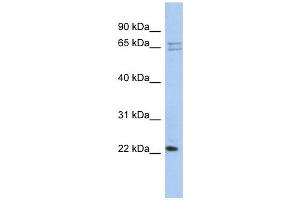 RPL18 antibody used at 1 ug/ml to detect target protein. (RPL18 抗体  (N-Term))