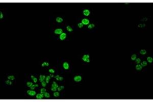 Immunofluorescent analysis of HepG2 cells using ABIN7139618 at dilution of 1:100 and Alexa Fluor 488-congugated AffiniPure Goat Anti-Rabbit IgG(H+L) (Histone H1.5 抗体  (pSer188))