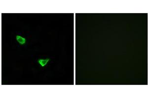 Immunofluorescence analysis of MCF-7 cells, using CHSS2 antibody. (CHPF 抗体  (C-Term))