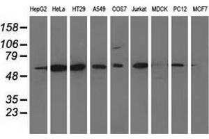 Western blot analysis of extracts (35 µg) from 9 different cell lines by using anti-CD80 monoclonal antibody. (CD80 抗体)