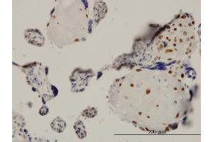 Immunoperoxidase of monoclonal antibody to TEAD4 on formalin-fixed paraffin-embedded human placenta. (TEAD4 抗体  (AA 1-361))