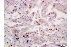 Immunohistochemistry (IHC) image for anti-Succinate Dehydrogenase Complex, Subunit B, Iron Sulfur (Ip) (SDHB) (AA 201-280) antibody (ABIN719411)