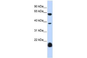 Serotonin receptor 3E antibody used at 1 ug/ml to detect target protein. (HTR3E 抗体)