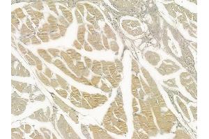 ABIN6258859 and ABIN6273464 at 1/100 staining human tongue carcinoma by IHC-P.