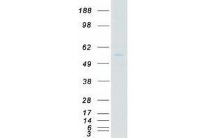 Western Blotting (WB) image for Megakaryocyte-Associated tyrosine Kinase (MATK) (Transcript Variant 1) protein (Myc-DYKDDDDK Tag) (ABIN2725549)