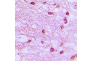 Immunohistochemical analysis of DNA Ligase 4 staining in human brain formalin fixed paraffin embedded tissue section. (LIG4 抗体  (Center))