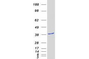 Western Blotting (WB) image for GIPC PDZ Domain Containing Family, Member 2 (GIPC2) protein (Myc-DYKDDDDK Tag) (ABIN2721888)