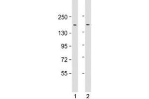 Western blot testing of human 1) HeLa and 2) SW480 cell lysate with LAP2 antibody at 1:1000. (Thymopoietin 抗体)