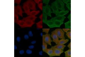 anti-CKLF-Like MARVEL Transmembrane Domain Containing 4 (CMTM4) (N-Term) antibody