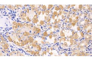 Immunohistochemistry (IHC) image for anti-Induced Myeloid Leukemia Cell Differentiation Protein Mcl-1 (MCL1) (AA 2-307) antibody (ABIN7440890)