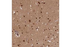 Immunohistochemical staining (Formalin-fixed paraffin-embedded sections) of human cerebral cortex with ADIG polyclonal antibody  shows strong nuclear positivity in glial cells. (ADIG 抗体)