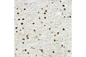 Immunohistochemistry of paraffin-embedded rat brain using TE Rabbit pAb (ABIN6129488, ABIN6148982, ABIN6148984 and ABIN6217332) at dilution of 1:100 (40x lens). (TEAD1 抗体  (AA 135-215))