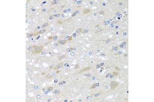 Immunohistochemistry of paraffin-embedded rat brain using NDUFS3 antibody. (NDUFS3 抗体  (AA 37-264))