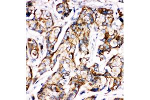 Anti-Sonic Hedgehog antibody,  IHC(P) IHC(P): Human Mammary Tissue (Sonic Hedgehog 抗体  (N-Term))
