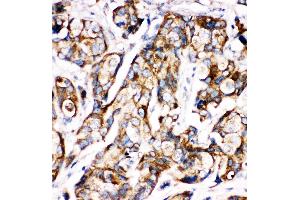 Anti-Sonic Hedgehog antibody,  IHC(P) IHC(P): Human Mammary Tissue