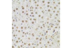 Immunohistochemistry of paraffin-embedded rat liver using HDGF Antibody. (HDGF 抗体  (AA 1-240))