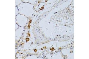 Immunohistochemistry of paraffin-embedded rat lung using PHGDH antibody. (PHGDH 抗体  (AA 264-533))