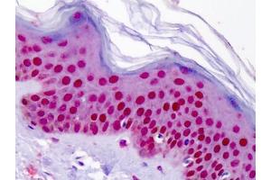 Human Skin: Formalin-Fixed, Paraffin-Embedded (FFPE) (Aryl Hydrocarbon Receptor 抗体  (N-Term))