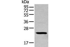 Western blot analysis of 293T cell using TCEAL4 Polyclonal Antibody at dilution of 1:250 (TCEAL4 抗体)