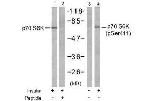 Image no. 2 for anti-Ribosomal Protein S6 Kinase, 70kDa, Polypeptide 1 (RPS6KB1) (pSer411) antibody (ABIN197035) (RPS6KB1 抗体  (pSer411))