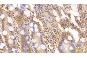 Detection of WNT3A in Human Small intestine Tissue using Monoclonal Antibody to Wingless Type MMTV Integration Site Family, Member 3A (WNT3A) (WNT3A 抗体  (AA 1-290))