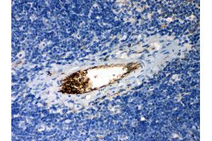 Immunohistochemistry (IHC) image for anti-serpin Peptidase Inhibitor, Clade A (Alpha-1 Antiproteinase, Antitrypsin), Member 1 (SERPINA1) (AA 211-411) antibody (ABIN3043431)