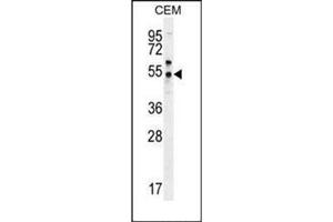 Western blot analysis of PSMAL Antibody (C-term) in CEM cell line lysates (35ug/lane). (FOLH1B 抗体  (C-Term))