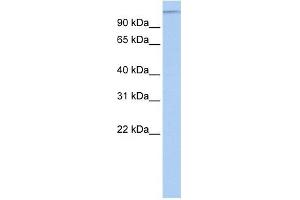 MTUS1 antibody used at 1 ug/ml to detect target protein. (MTUS1 抗体  (Middle Region))