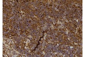 ABIN6266579 at 1/100 staining Mouse spleen tissue by IHC-P. (NOS2 抗体  (C-Term))