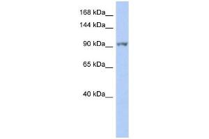 NEK9 antibody used at 1 ug/ml to detect target protein.